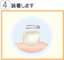 装着します