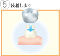 装着します