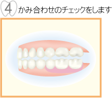 かみ合せのチェックをします