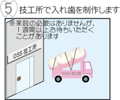 技工所で入れ歯を制作します
