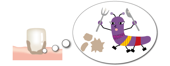 どうして歯周病になるの